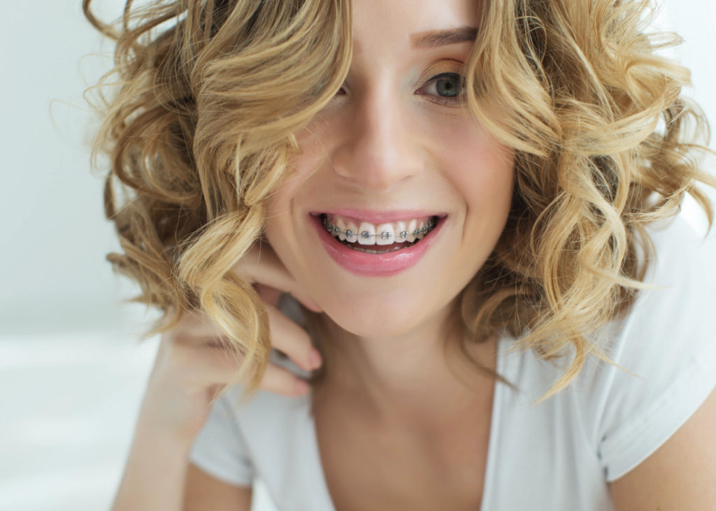 Ortodoncia | Lola Escalante Estudio Dental 2